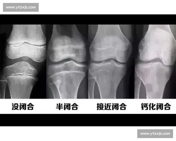 18 岁骨骺线未闭合？科学 3 招助你再长高 5cm